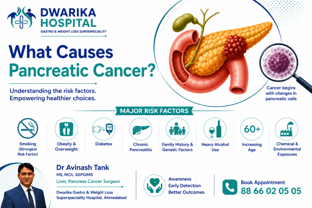 What Causes Pancreatic Cancer? Risk Factors, Genetics, Lifestyle and Prevention