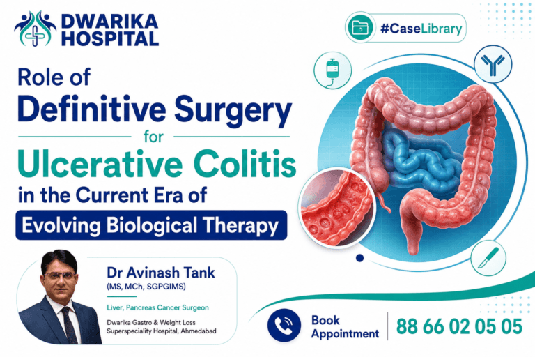 Role of Definitive Surgery for Ulcerative Colitis in the Current Era of Evolving Biological Therapy