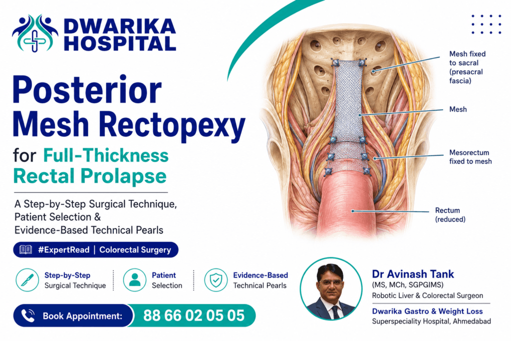 Posterior Mesh Rectopexy for Full-Thickness Rectal Prolapse