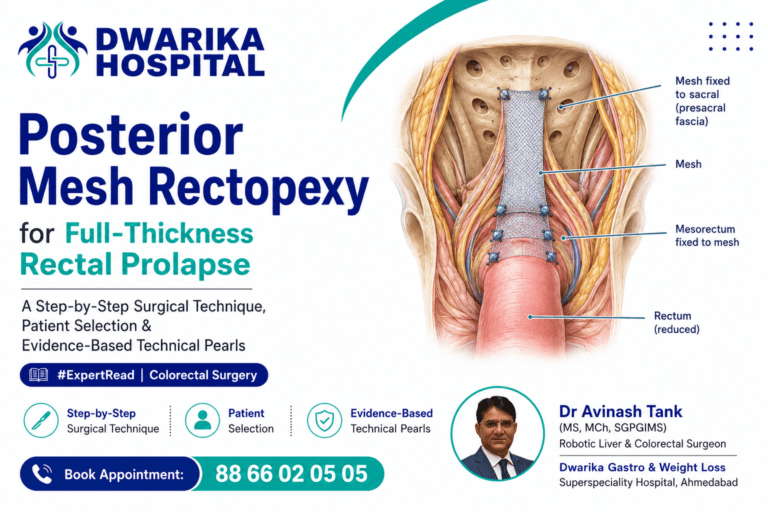 Posterior Mesh Rectopexy for Full-Thickness Rectal Prolapse