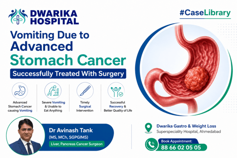 Vomiting due to Stomach Cancer Successfully Treated With Surgery