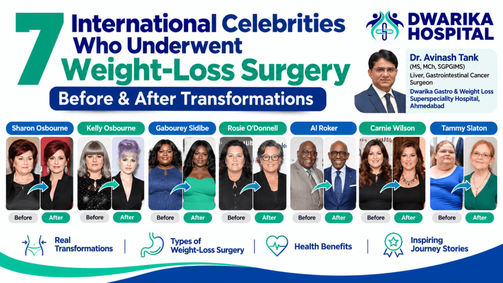 7 International Celebrities Who Underwent Weight-Loss Surgery: Before & After Transformations