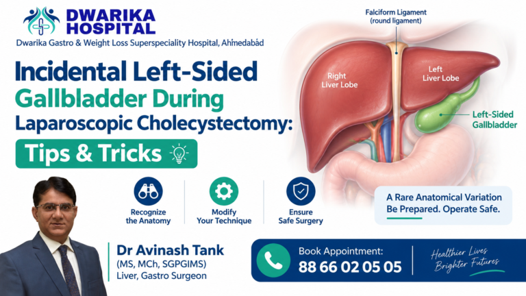 Incidental Left-Sided Gallbladder During Laparoscopic Cholecystectomy: Tips & Tricks