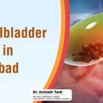 Best Gallbladder Surgeon in Ahmedabad