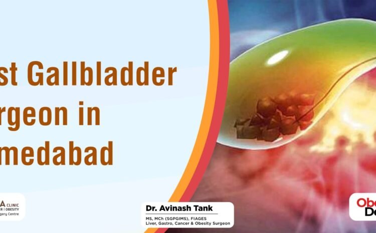 Best Gallbladder Surgeon in Ahmedabad