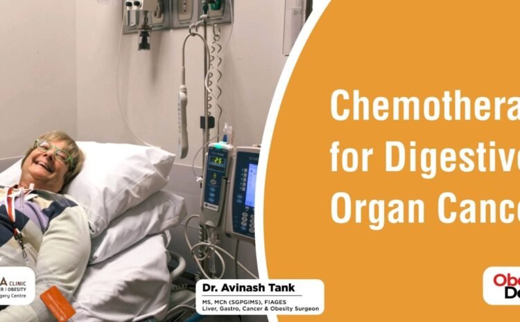 Chemotherapy for Digestive Organ Cancer