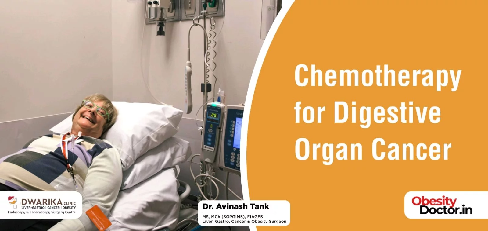 Chemotherapy for Digestive Organ Cancer