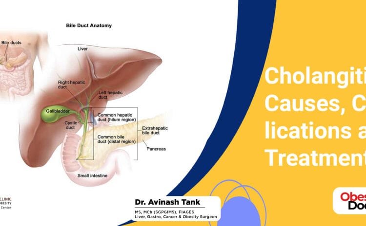 Cholangitis: Causes, Complications and Treatment