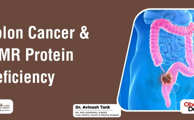 Colon Cancer & MMR Protein Deficiency