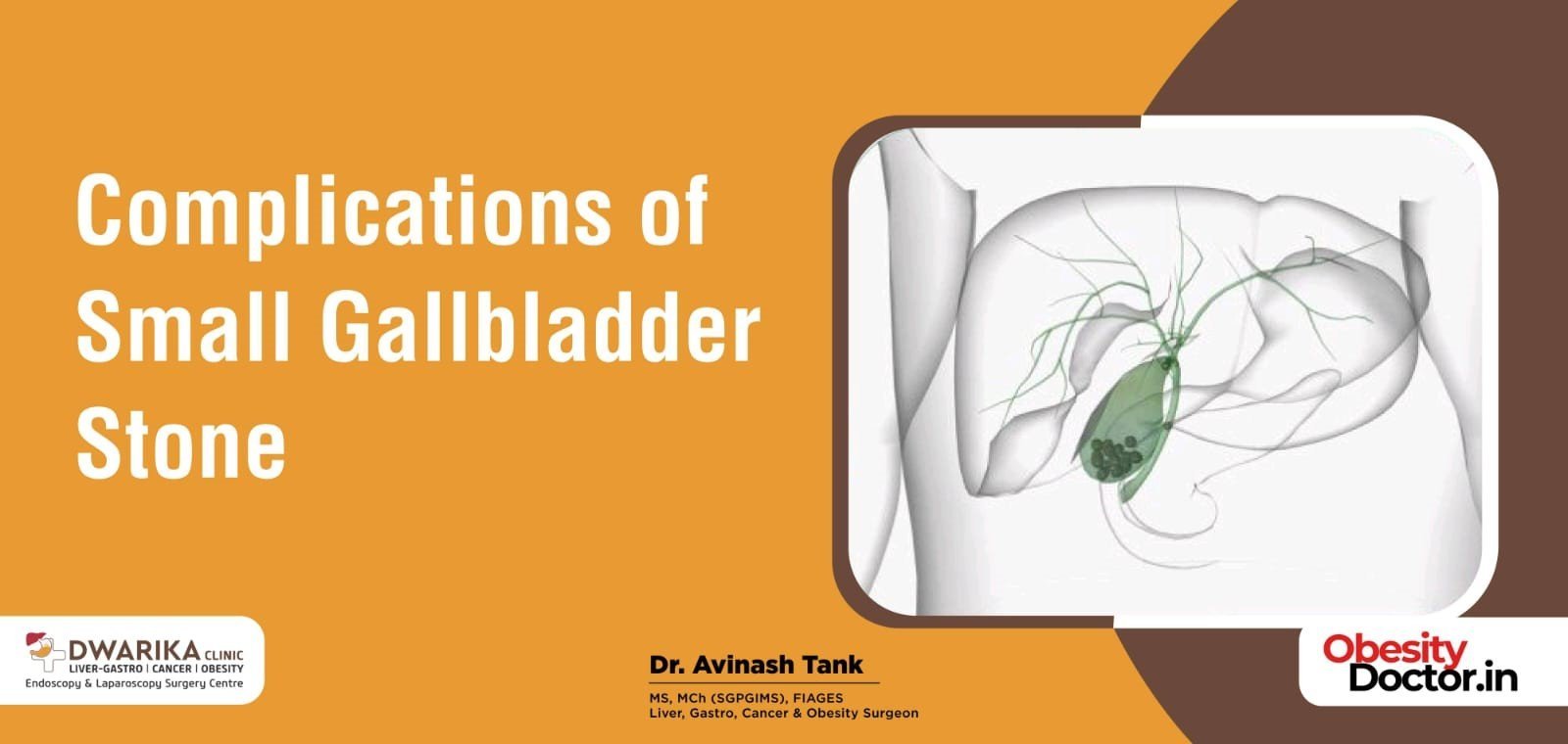 Complications of Small Gallbladder Stone