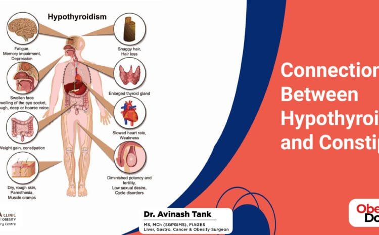 Connection Between Hypothyroidism and Constipation