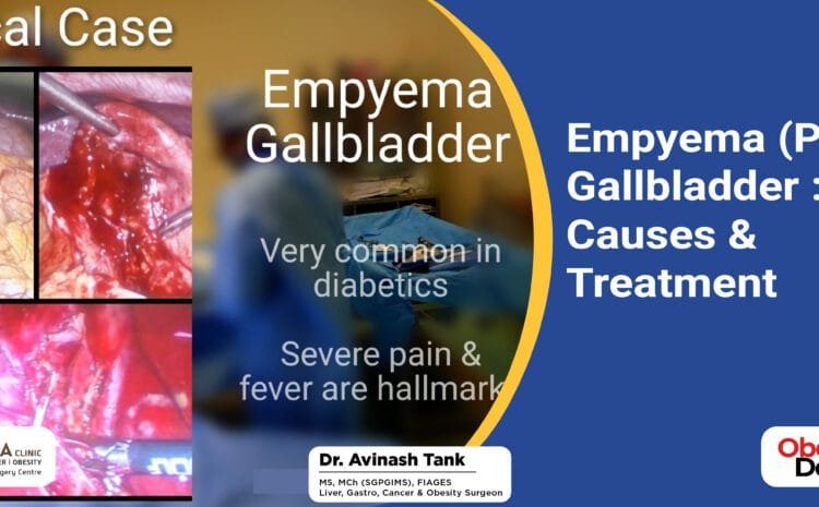 Empyema (Pus in) Gallbladder : Causes & Treatment