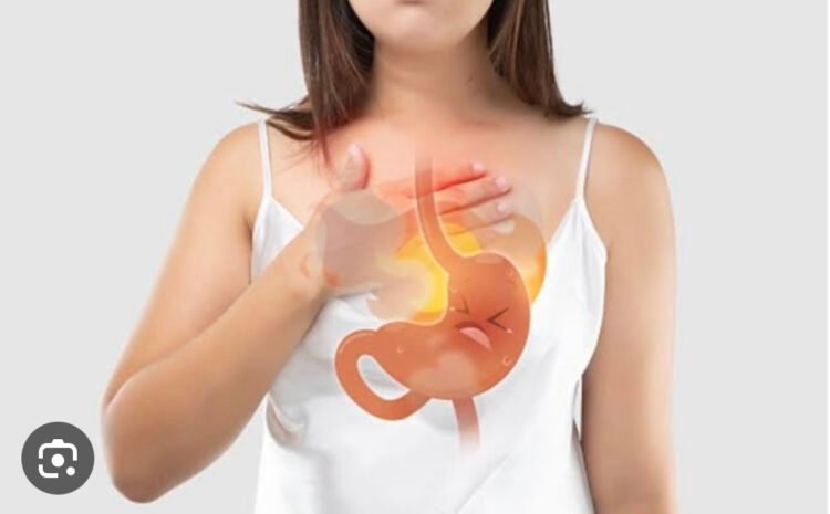 Acidity Treatment in Bopal, Ahmedabad