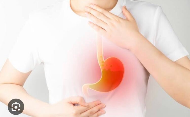 Complications of Reflux: Causes, Treatment, and Aftercare