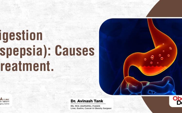 Indigestion (Dyspepsia): Causes & Treatment