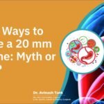Natural Ways to Dissolve a 20 mm Gallstone: Myth or Reality?