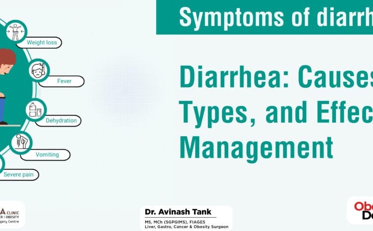 Diarrhea: Causes, Types, and Effective Management