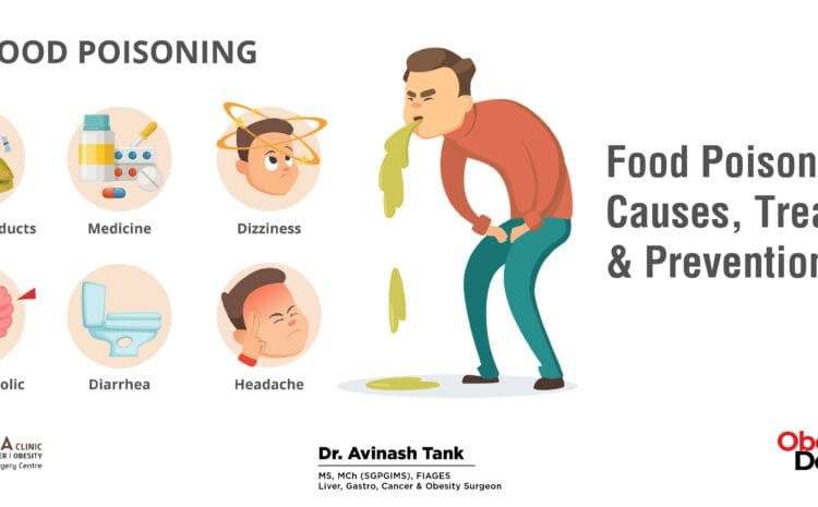 Food Poisoning: Causes, Treatment & Prevention