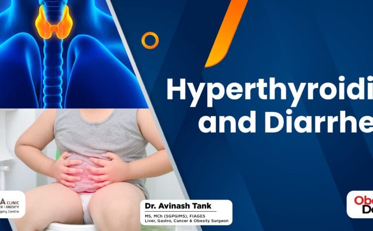 Hyperthyroidism and Diarrhea