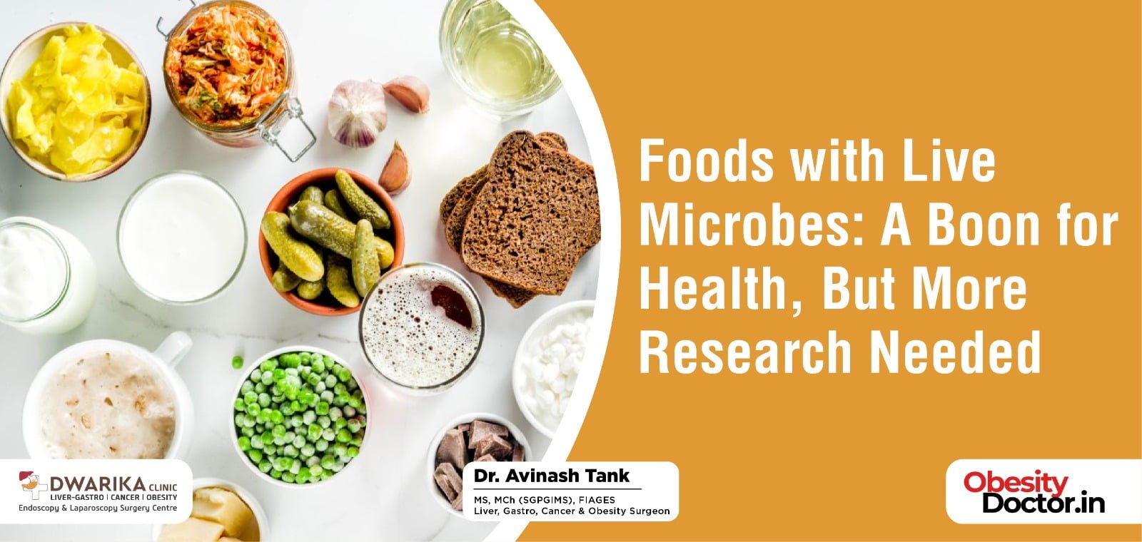 Foods with Live Microbes: A Boon for Health, But More Research Needed.