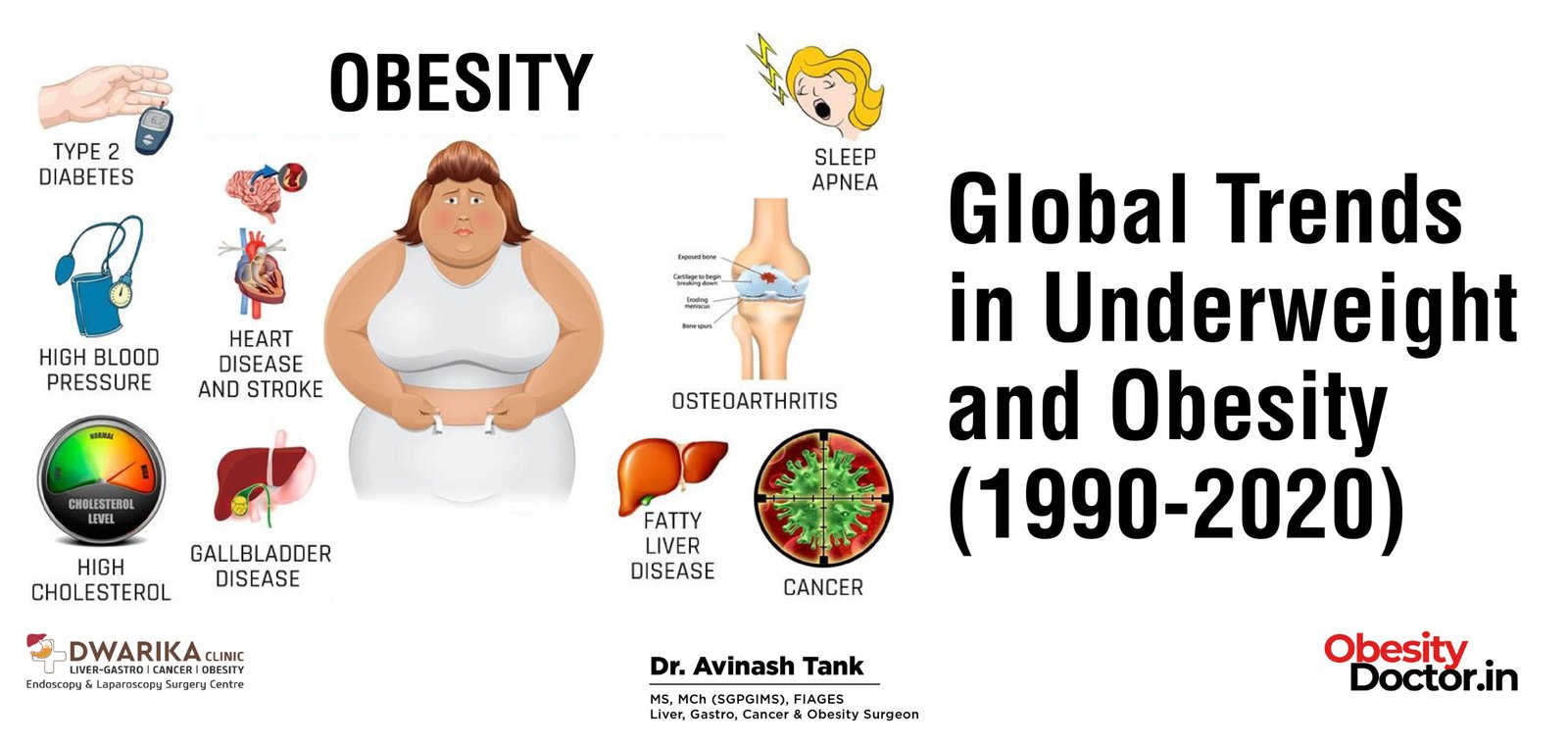 Fatty Liver Doubles Death Risk After Organ Transplant