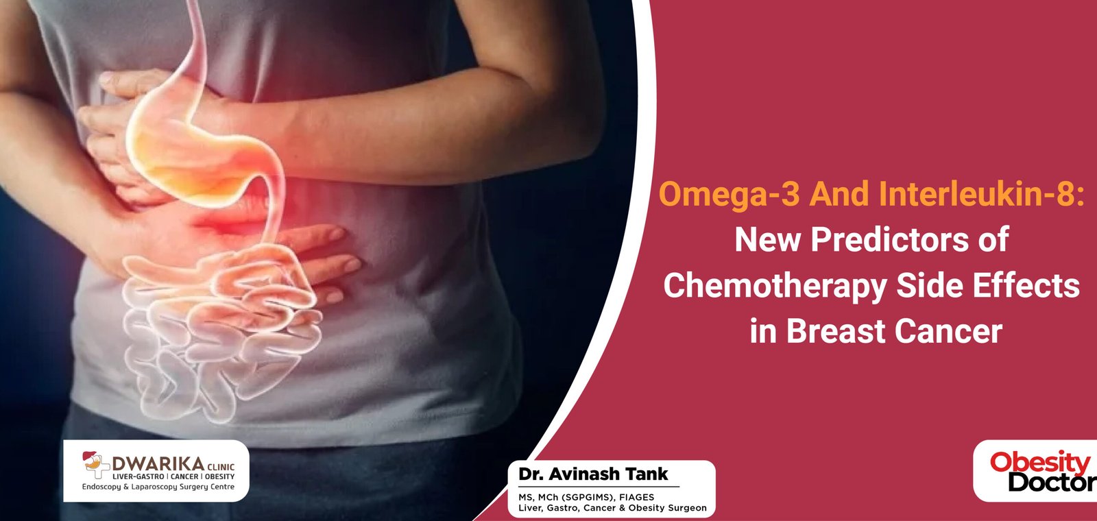 Omega-3 and Interleukin-8: New Predictors of Chemotherapy Side Effects in Breast Cancer