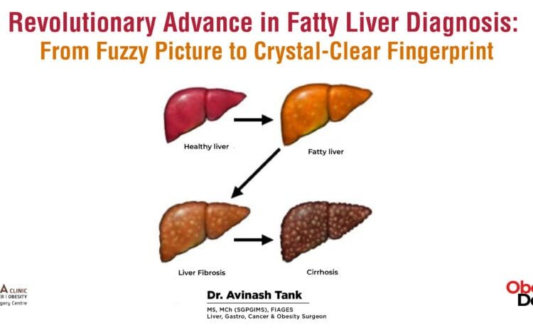 Revolutionary Advance in Fatty Liver Diagnosis: From Fuzzy Picture to Crystal-Clear Fingerprint