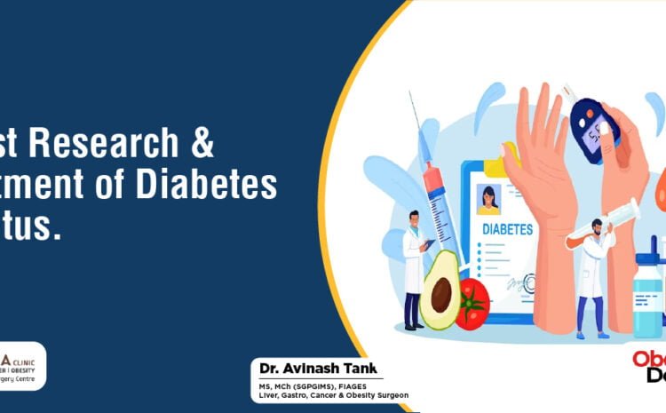 Latest Reaserch & Treatment of Diabetes Mallitus.
