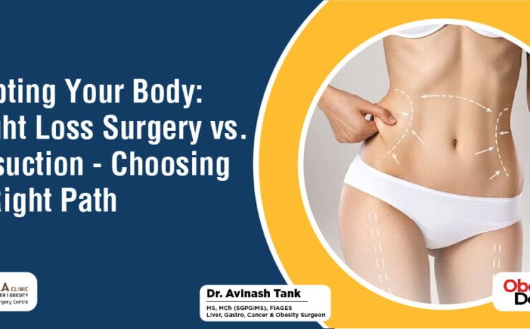 Sculpting Your Body Weight Loss Surgery vs Liposuction - Choosing the Right Path