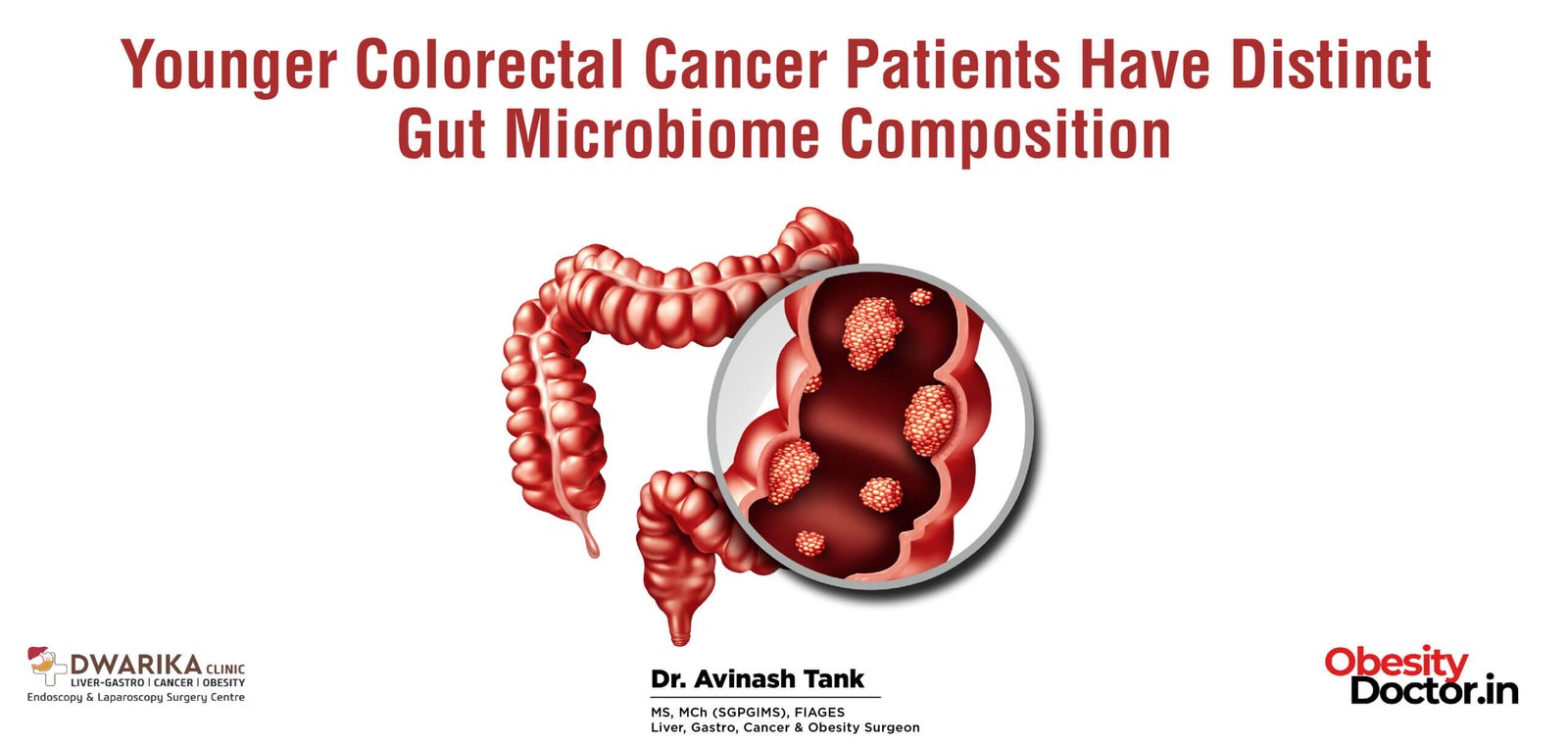 Younger Colorectal Cancer Patients Have Distinct Gut Microbiome Composition