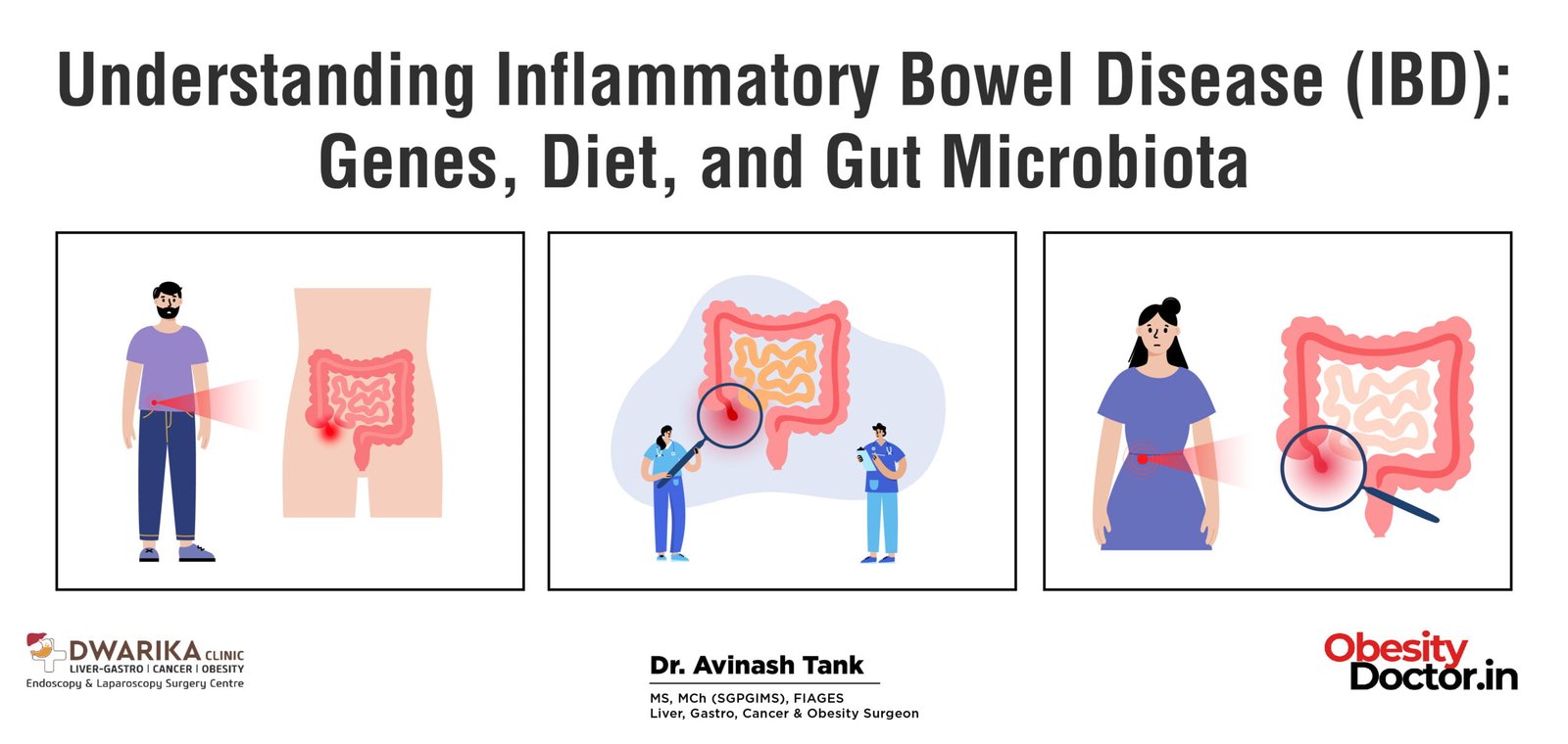 Understanding Inflammatory Bowel Disease (IBD): Genes, Diet, and Gut Microbiota