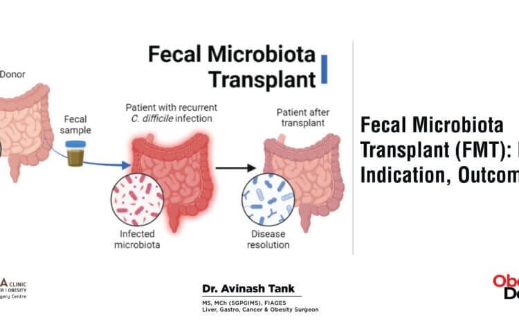 Fecal Microbiota Transplant (FMT): Process, Indication, Outcome.