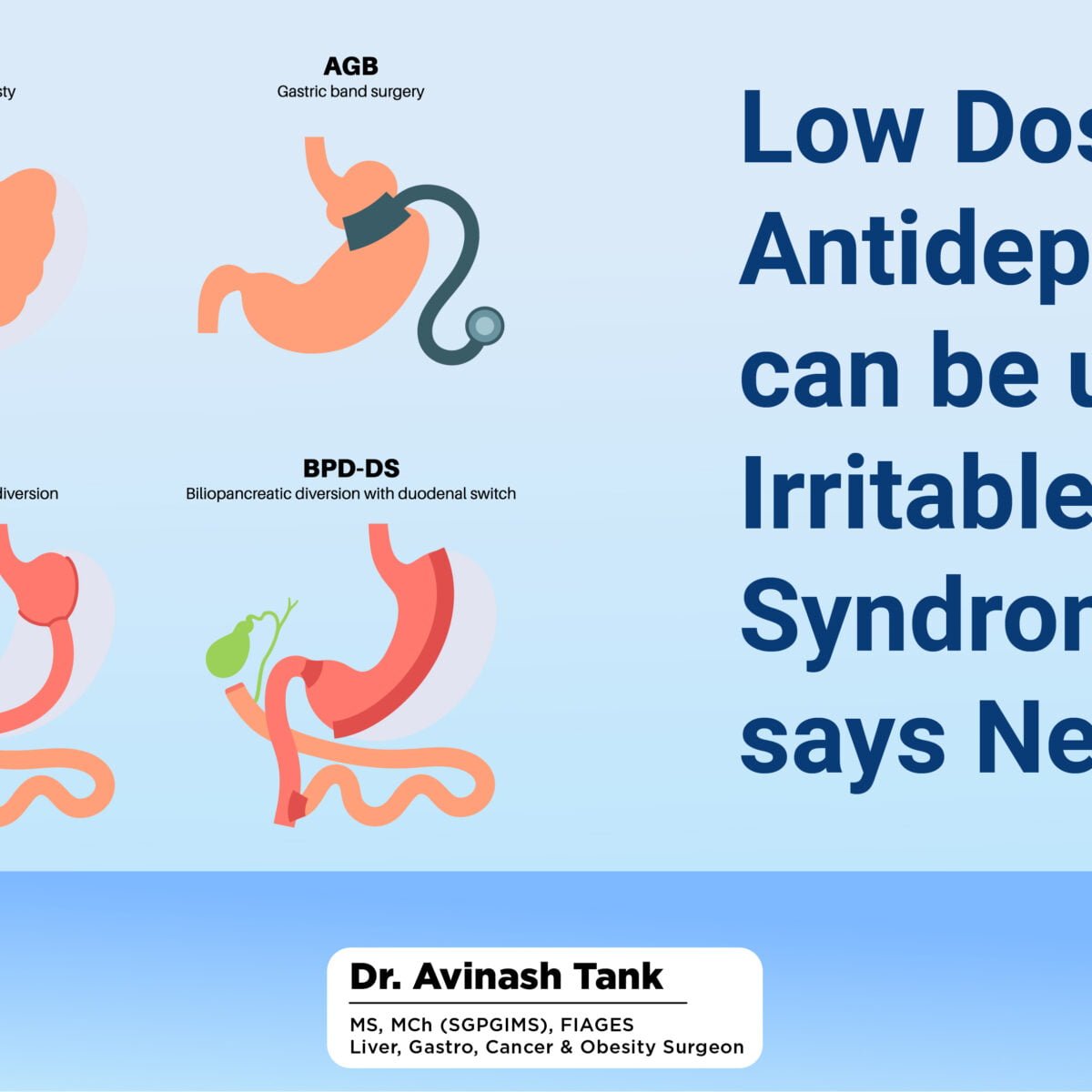 tirzepatide and ibs Low Dose Antidepressants can be useful for Irritable Bowel Syndrome (IBS)  says New Study