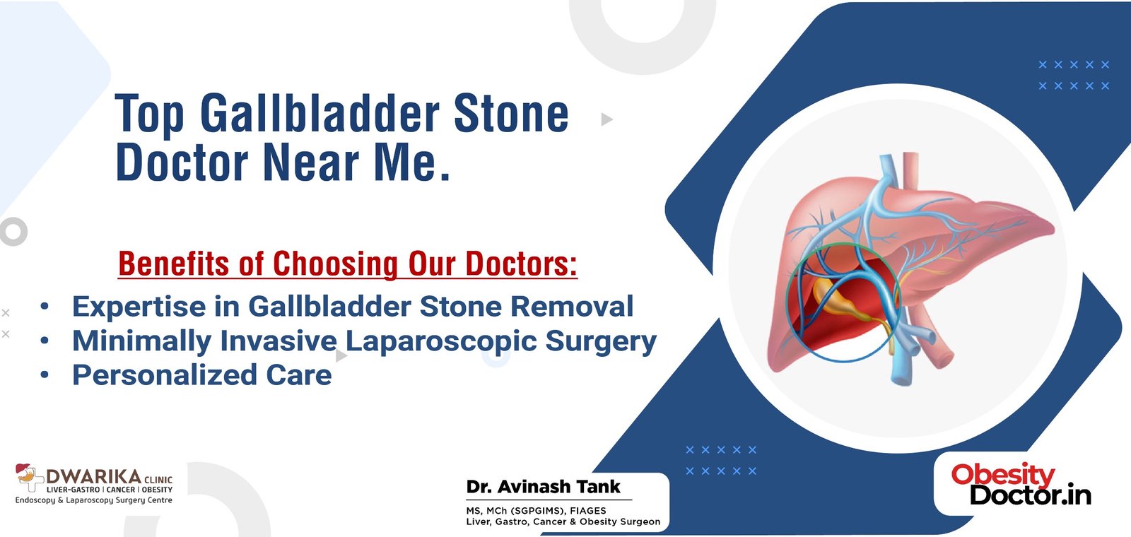 Top Gallbladder Stone Doctor Near Me.