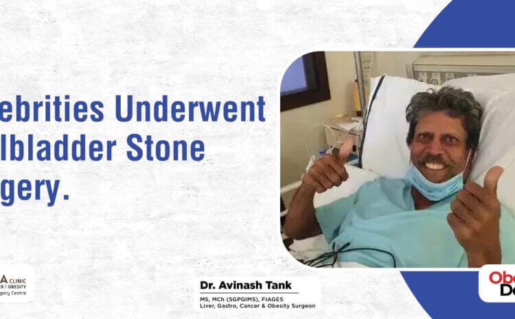Celebrities Underwent Gallbladder Stone Surgery