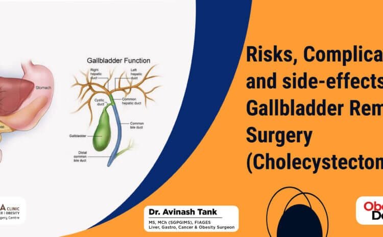Risks, Complications, and side-effects after Gallbladder Removal Surgery (Cholecystectomy).
