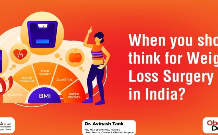 When you should think for Weight Loss Surgery in India?
