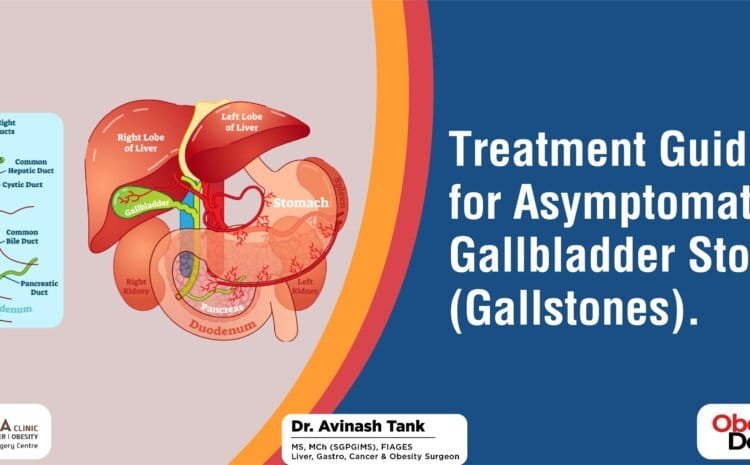 Treatment Guideline for Asymptomatic Gallbladder Stones (Gallstones).