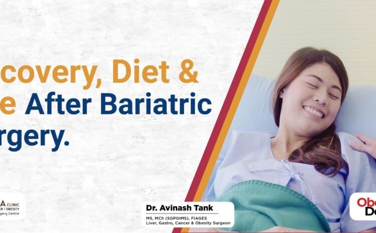 Recovery, Diet & Life After Bariatric Surgery.
