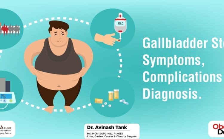 Gallbladder Stones: Symptoms, Complications & Diagnosis.