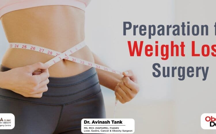Preparation for Weight Loss Surgery