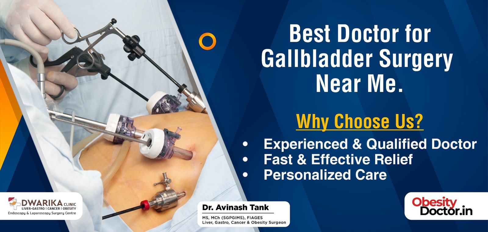 Best Doctor for Gallbladder Surgery Near Me.