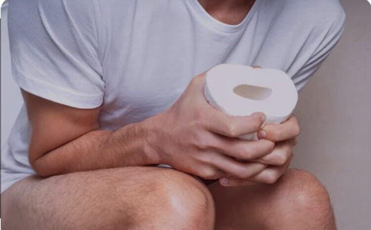 Mucus Discharge from Rectum after Stoma Surgery