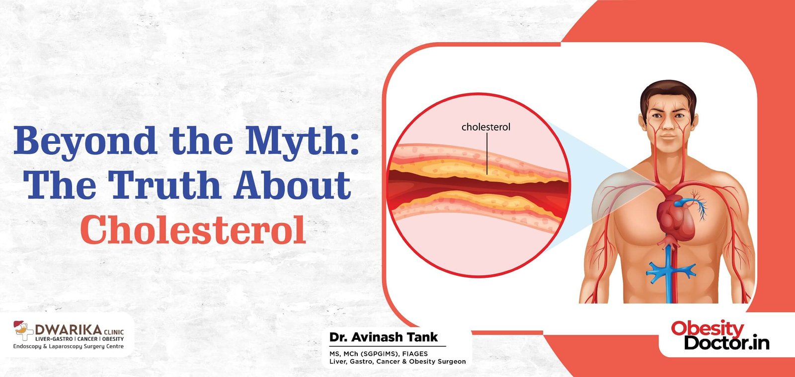 Beyond the Myth: The Truth About Cholesterol.