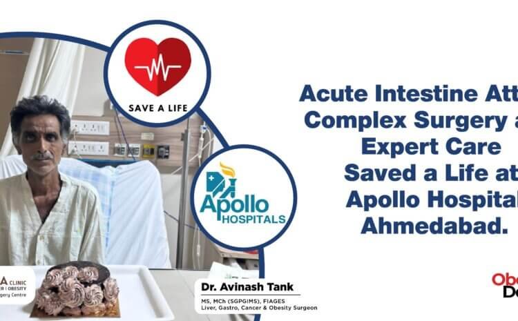 Acute Intestine Attack: Complex Surgery and Expert Care Saved a Life at Apollo Hospital Ahmedabad