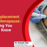 Hormone Replacement Therapy for Menopause: Everything You Need to Know