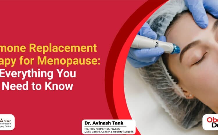 Hormone Replacement Therapy for Menopause: Everything You Need to Know