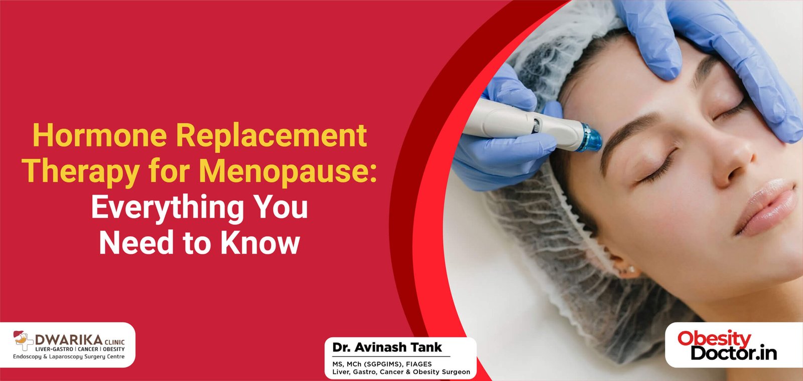 Hormone Replacement Therapy for Menopause: Everything You Need to Know