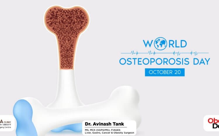 World Osteoporosis Day: Myths and Facts about Bone Health