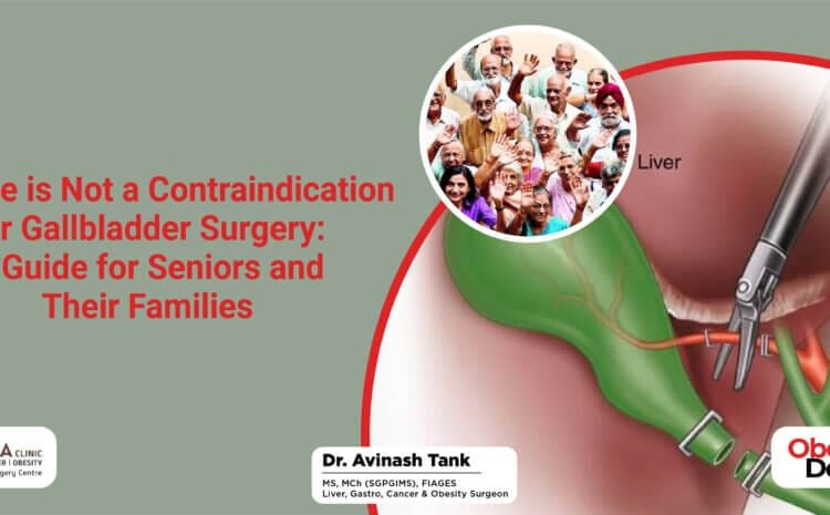 Old Age is Not a Contraindication for Gallbladder Surgery: A Guide for Seniors and Their Families